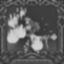 Blazing Blood Icon
